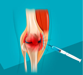 prolotherapy knee pain Ankara