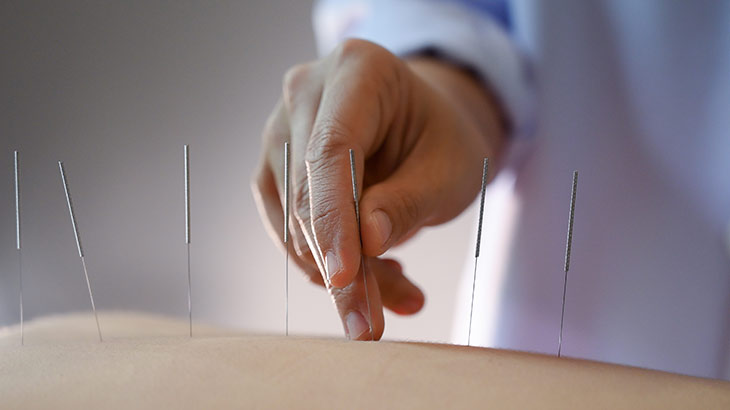 obesity treatment with acupuncture Ankara Turkey